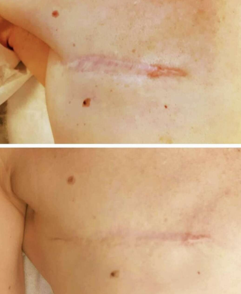 Lea Dermorepair Tatouage Therapeutique Avignon Dermo Repair