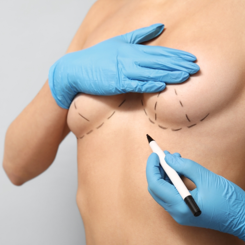 Lea Dermorepair Tatouage Therapeutique Avignon Operation Symetrisation